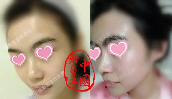 6119e850ly4gyb5i130ltj20iw0ayweu.jpg
