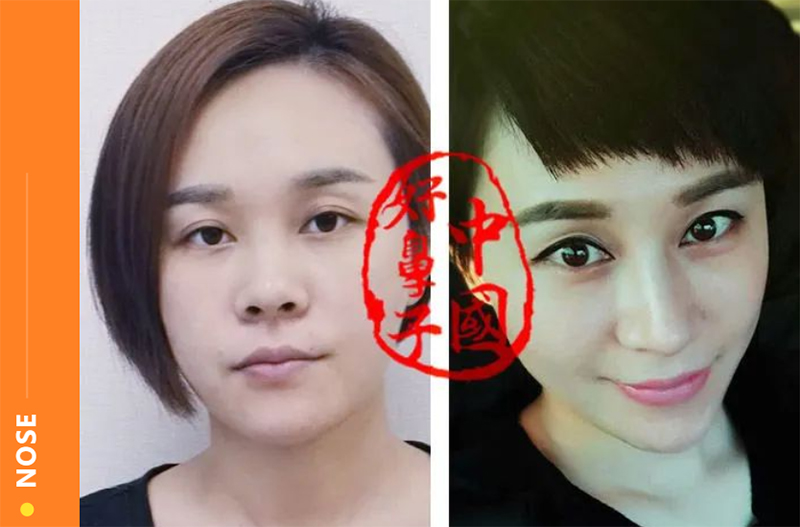 鼻尖形态对人形象塑造的直接作用
