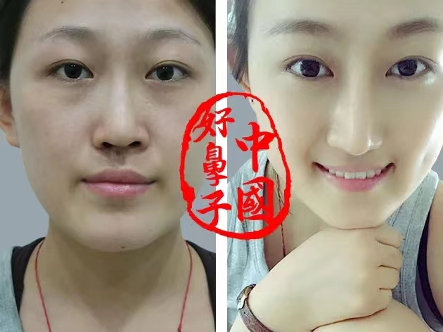 为什么那么多人喜欢折腾鼻子？