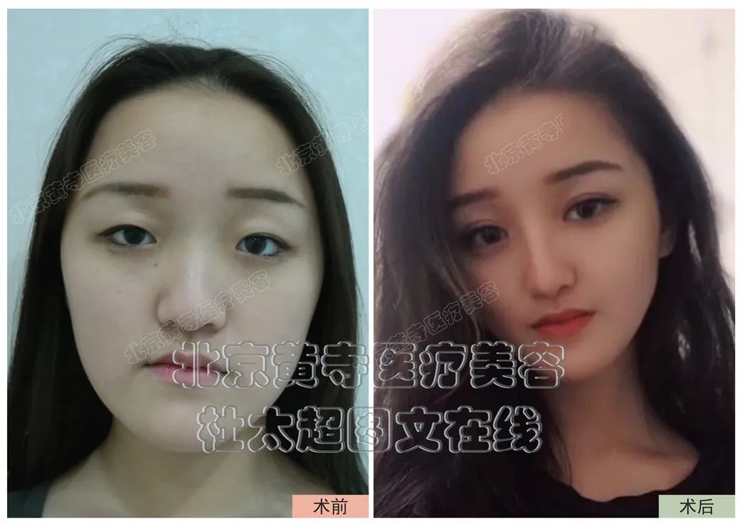 这样的鼻子你有吗？