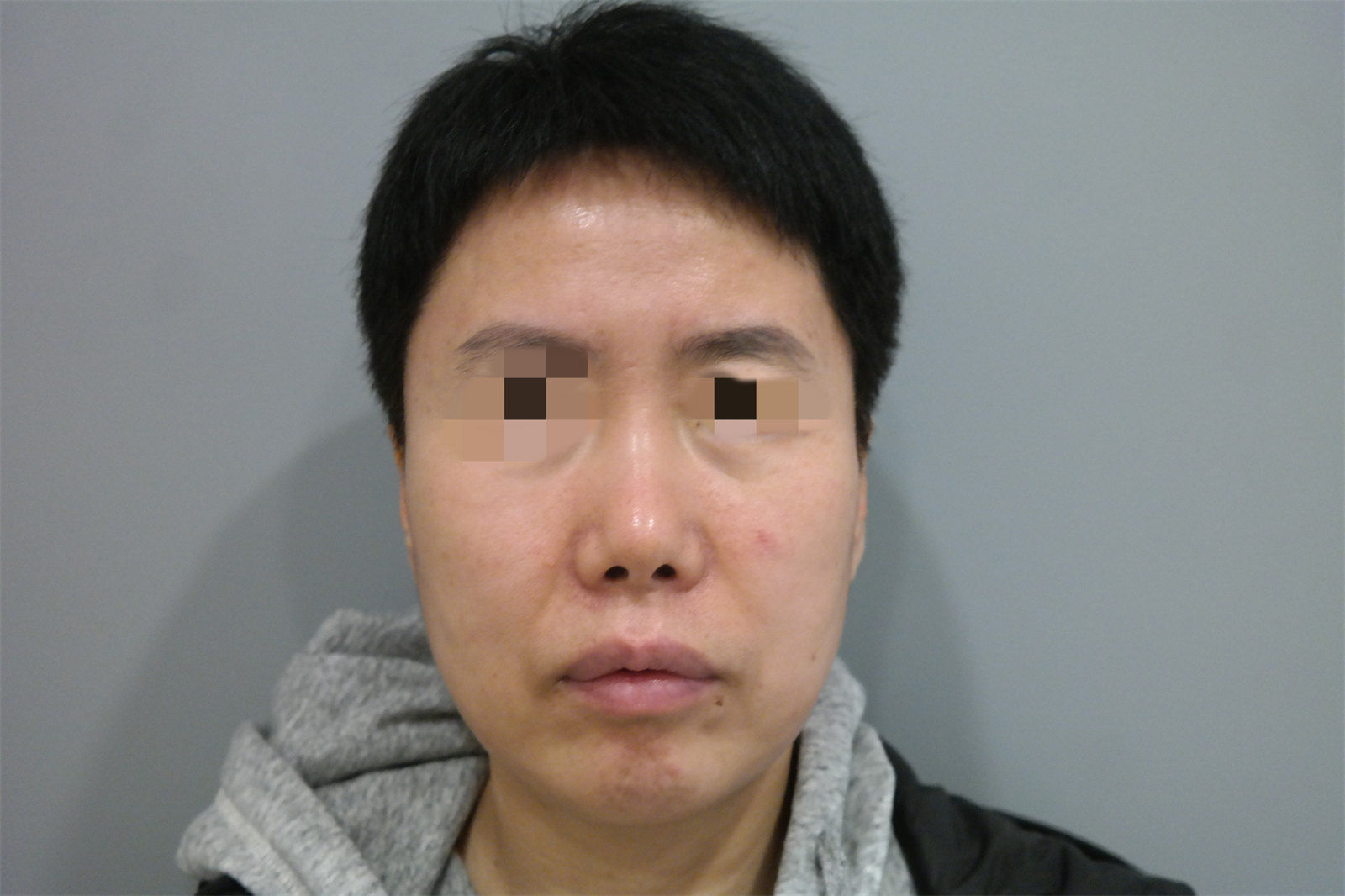 迈过50岁笔直大关的我：如何借由杜太超教授的专业技术，成功挽回落寞青春！