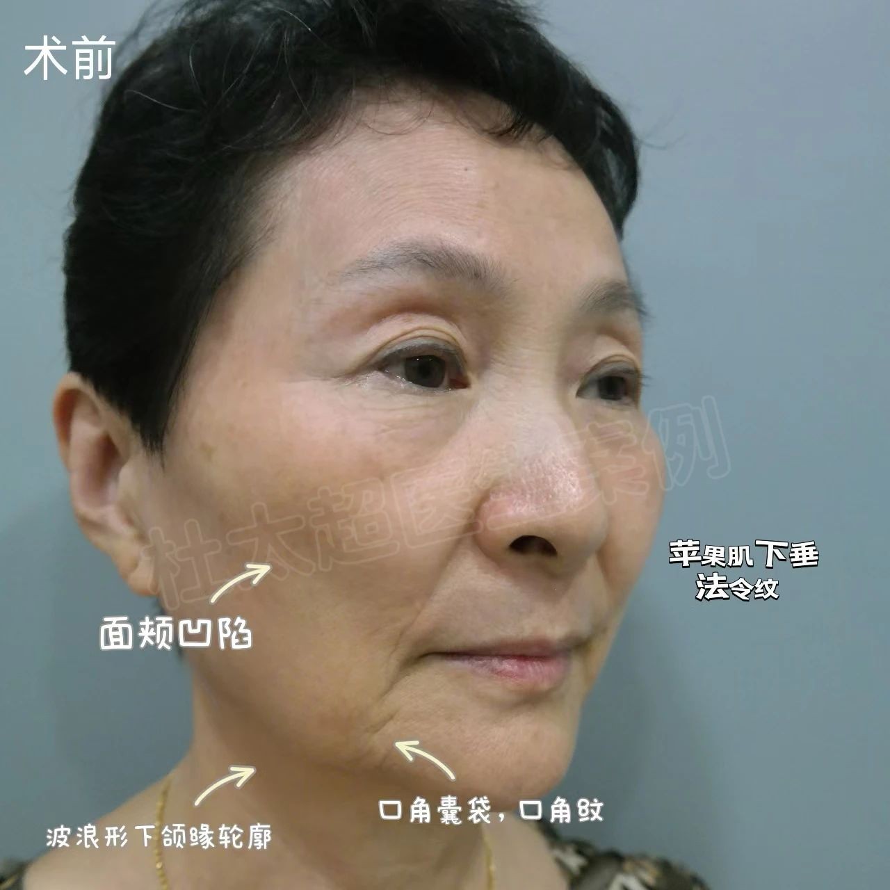 微信图片_20250218083551.jpg
