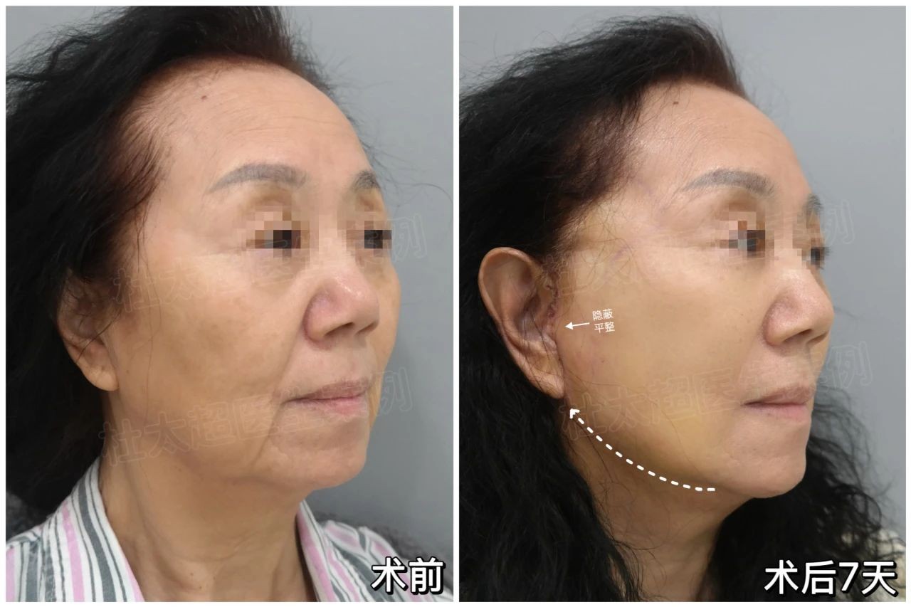 微信图片_20250324085841.jpg