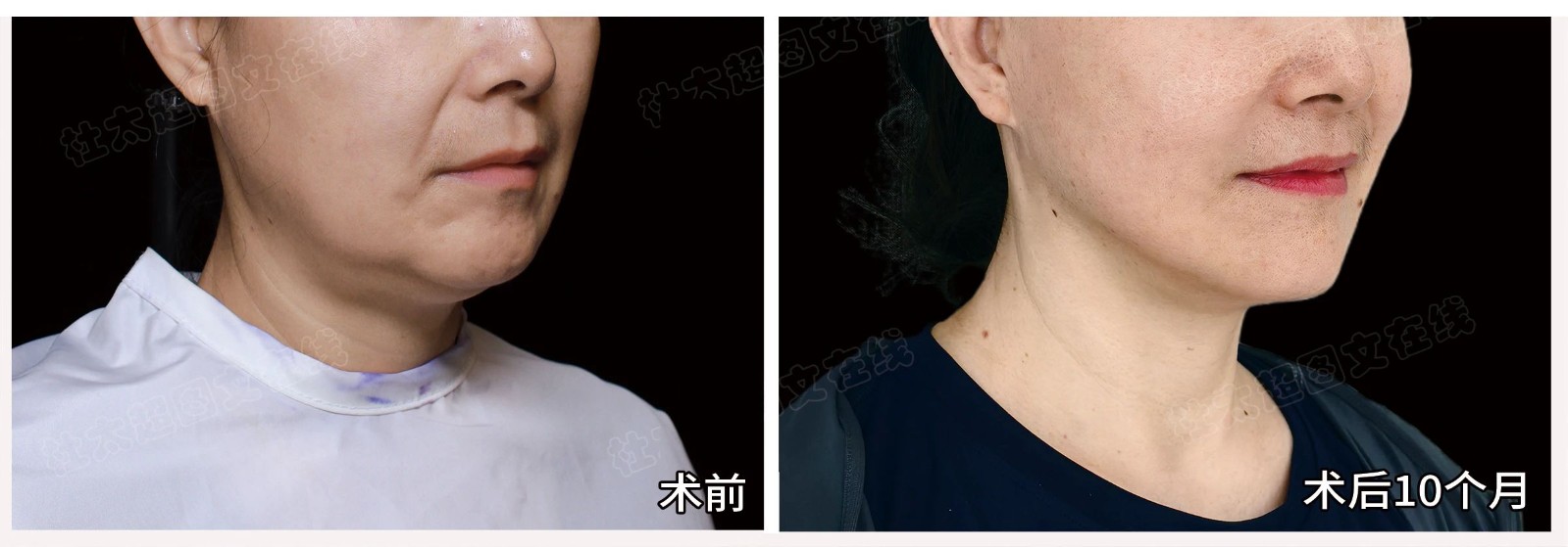 微信图片_2025-08-13_080235_138.jpg
