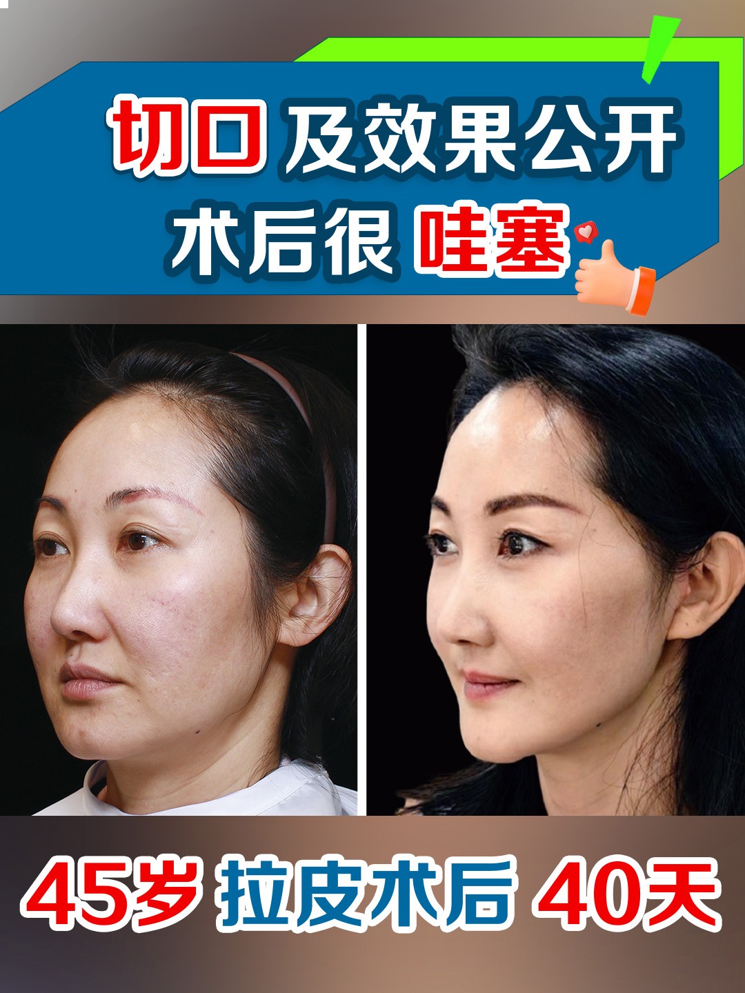 切口及效果公开岁.jpg